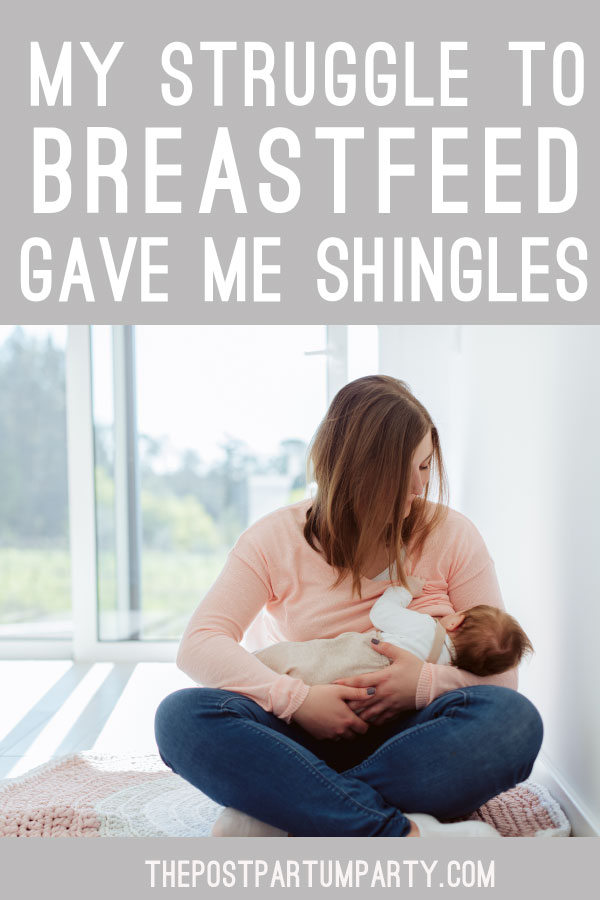 shingles and breastfeeding