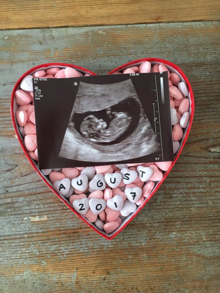 Valentine's Day pregnancy announcement with ultrasound and candy