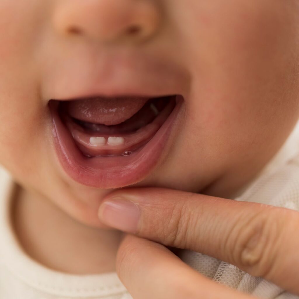 Teething baby showing teeth